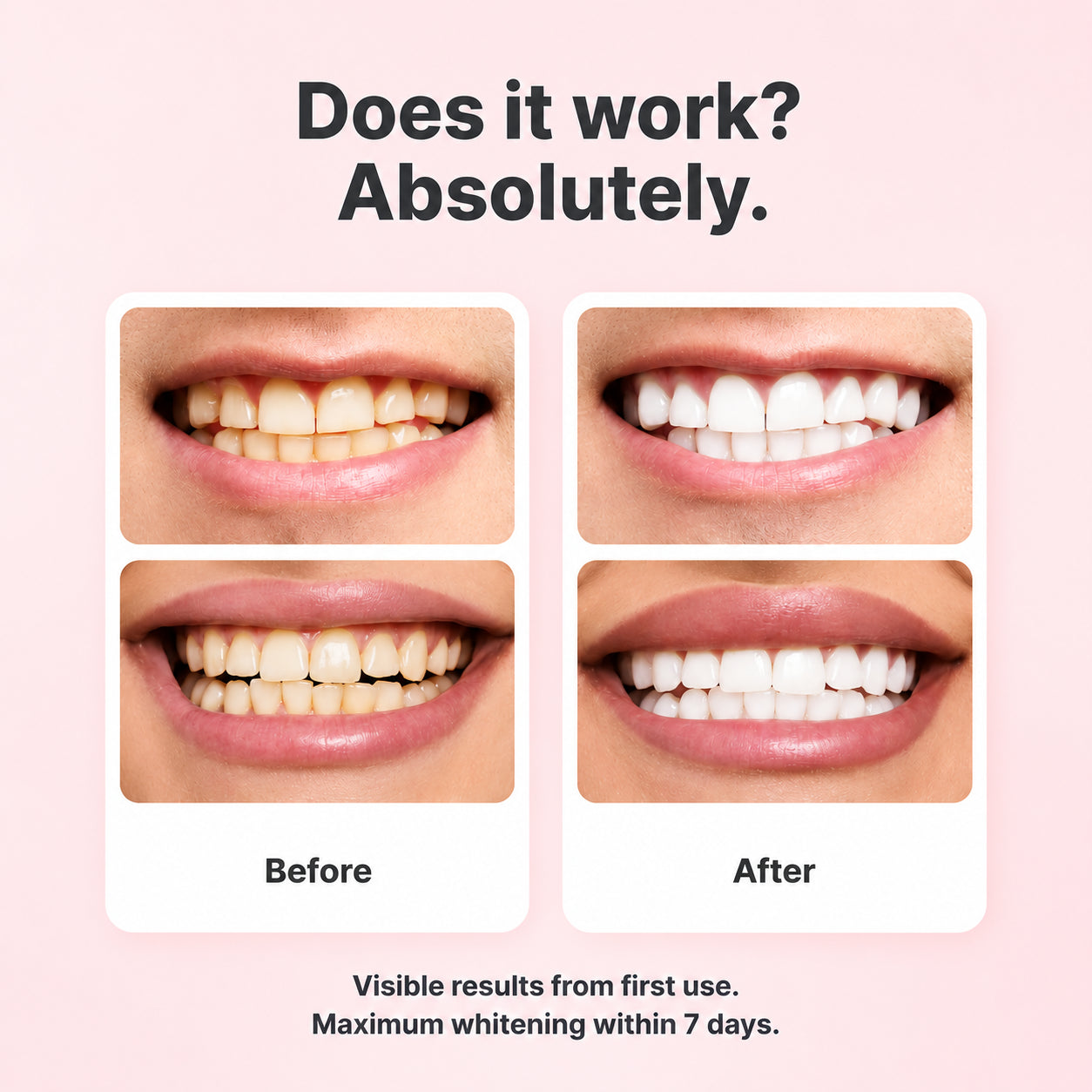 Feimuko™ Smile Polish