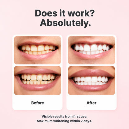 Feimuko™ Smile Polish