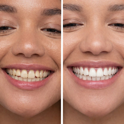 Feimuko™ Smile Polish